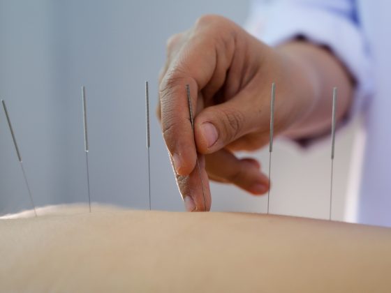 Beneficiile acupuncturii pentru persoanele în vârstă